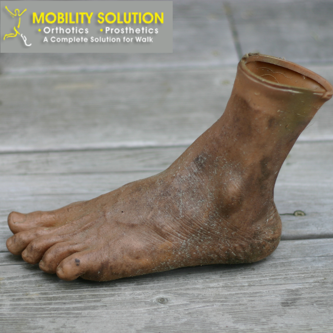 Prosthetic Foot: A Complete Guide to Types, Foot & Ankle Features, and Pricing