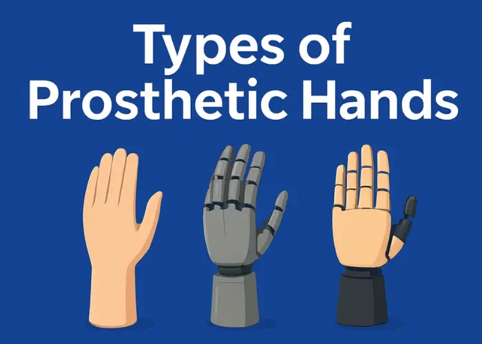 type of prosthetic hand