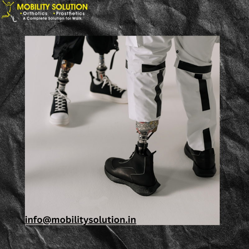 Artificial Leg Cost in India: Price, Types & Full Guide