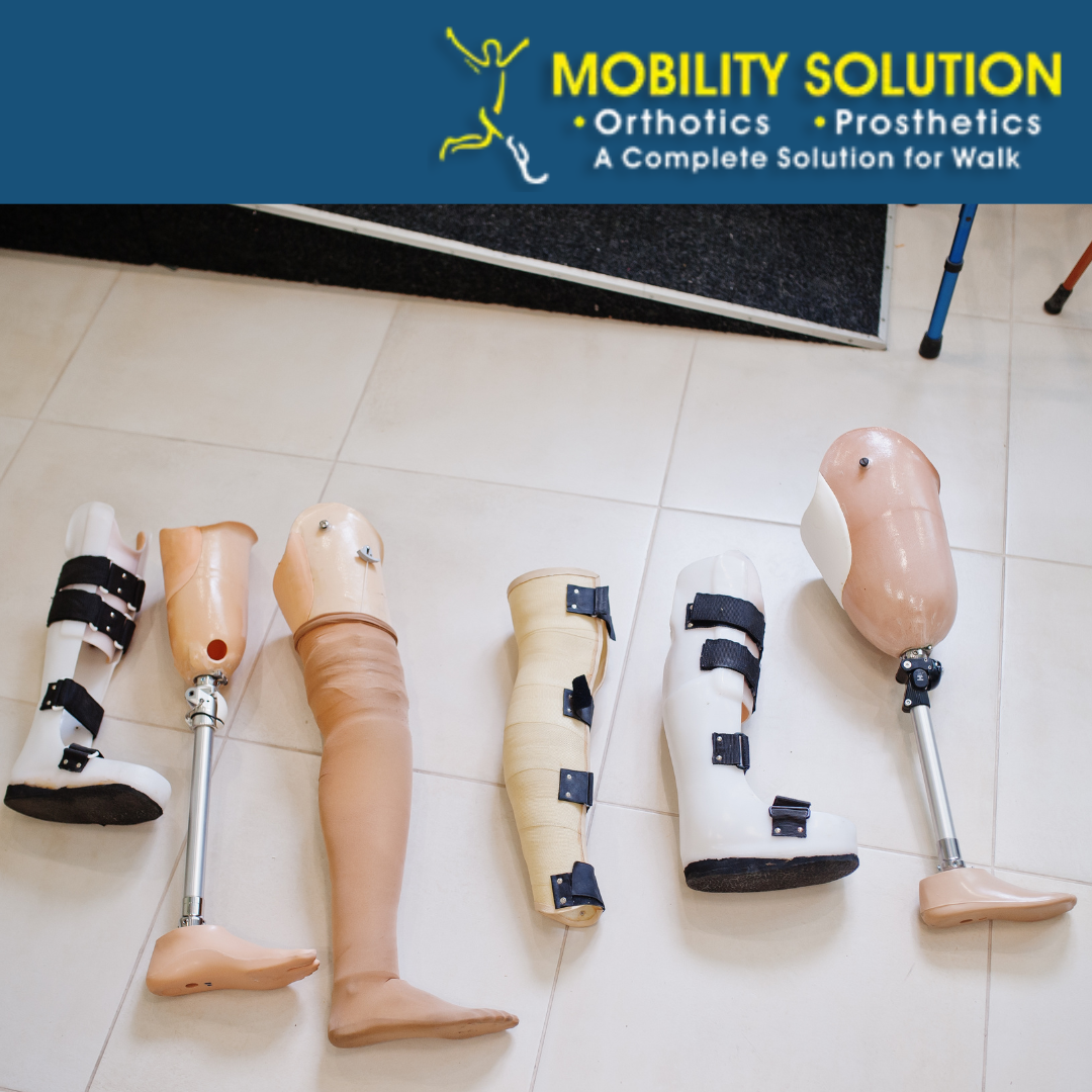 "Get the Best Artificial Leg Above Knee in India: Cost and Benefits"