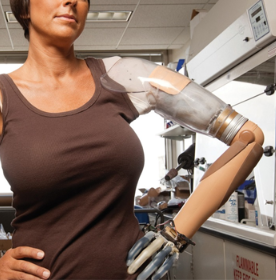 Shoulder Disarticulation